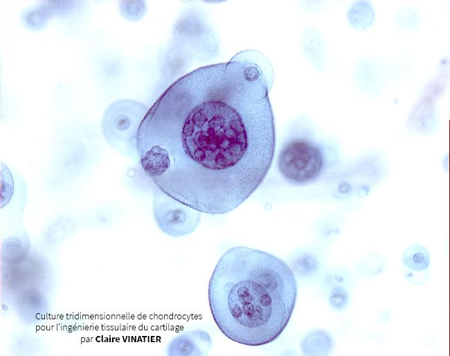 Chondrocytes en 3D